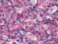 CASR/Calcium Sensing Receptor Antibody (N-Terminus)
